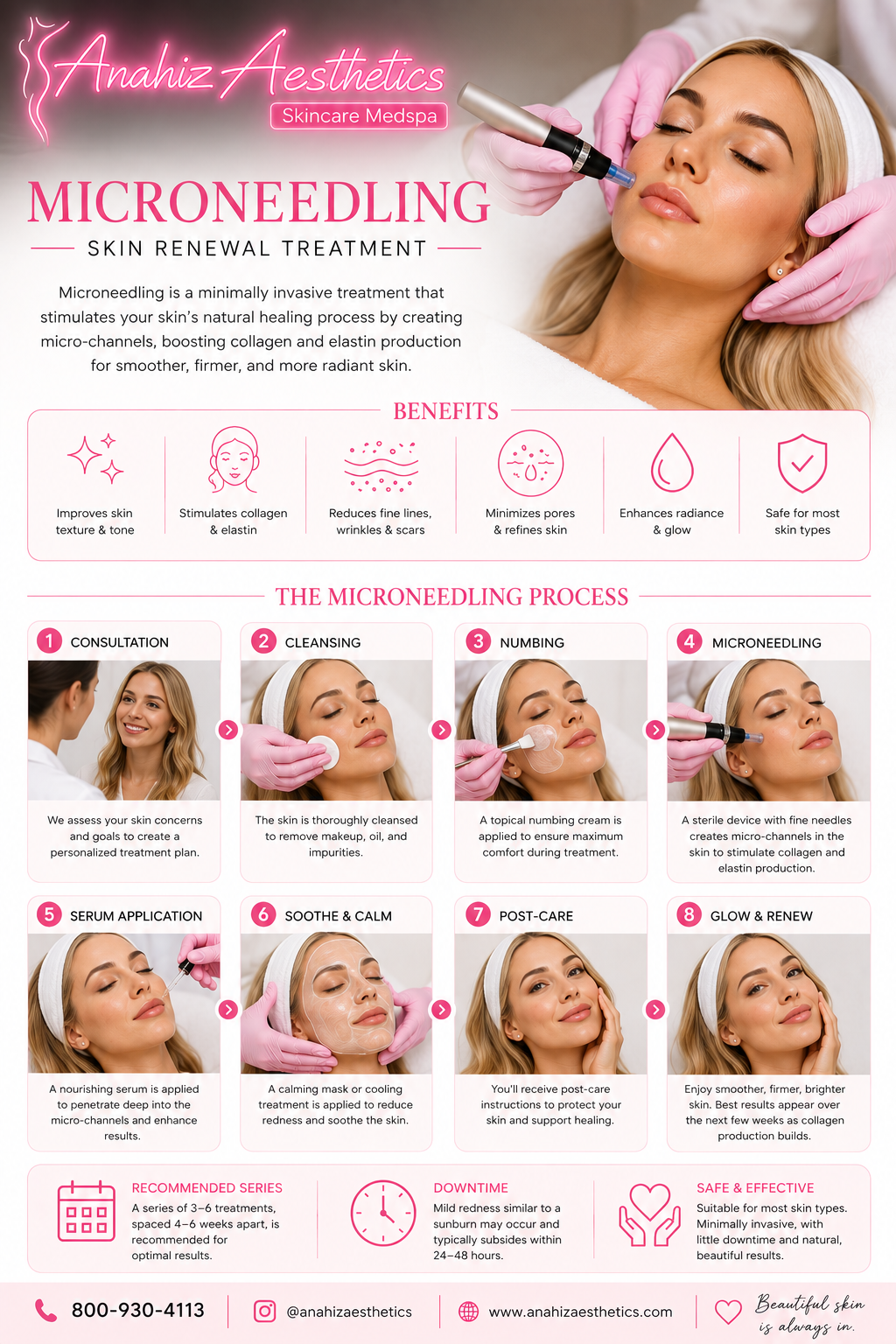 Microneedling Skin Renewal Treatment — Anahiz Aesthetics 8-step process with benefits, consultation through glow and renew