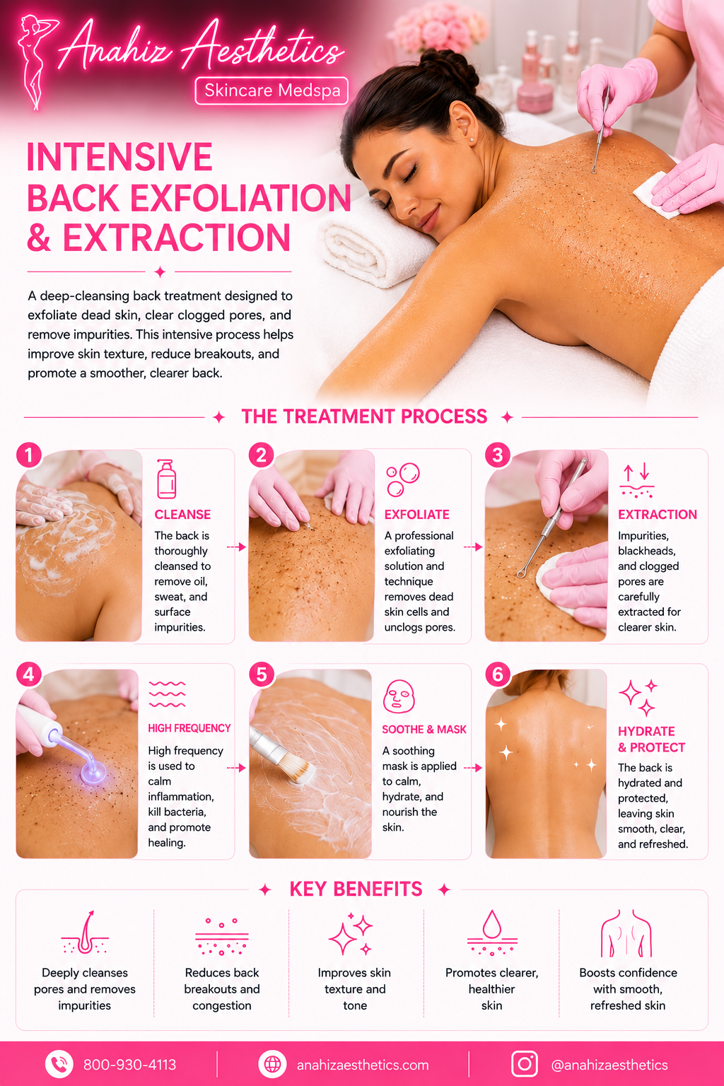 Intensive Back Exfoliation and Extraction — Anahiz Aesthetics 6-step process: cleanse, exfoliate, extraction, high frequency, soothe and mask, hydrate and protect. Key benefits: deeply cleanses pores, reduces back breakouts, improves skin texture and tone