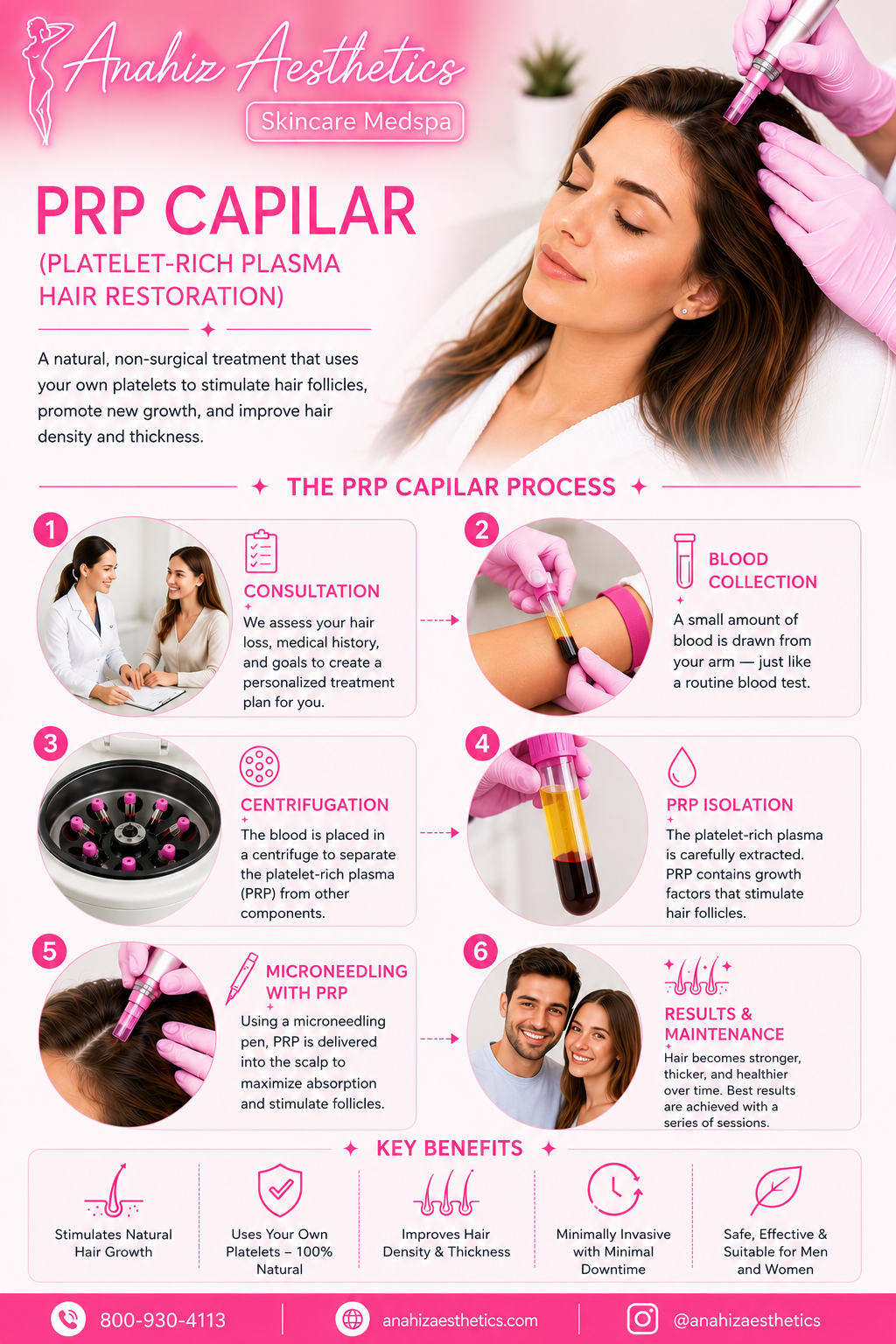 Scalp PRP Hair Restoration — Anahiz Aesthetics 6-step process: consultation, blood collection, centrifugation, PRP isolation, microneedling with PRP, results and maintenance. Key benefits: stimulates natural hair growth, uses your own platelets, improves hair density and thickness