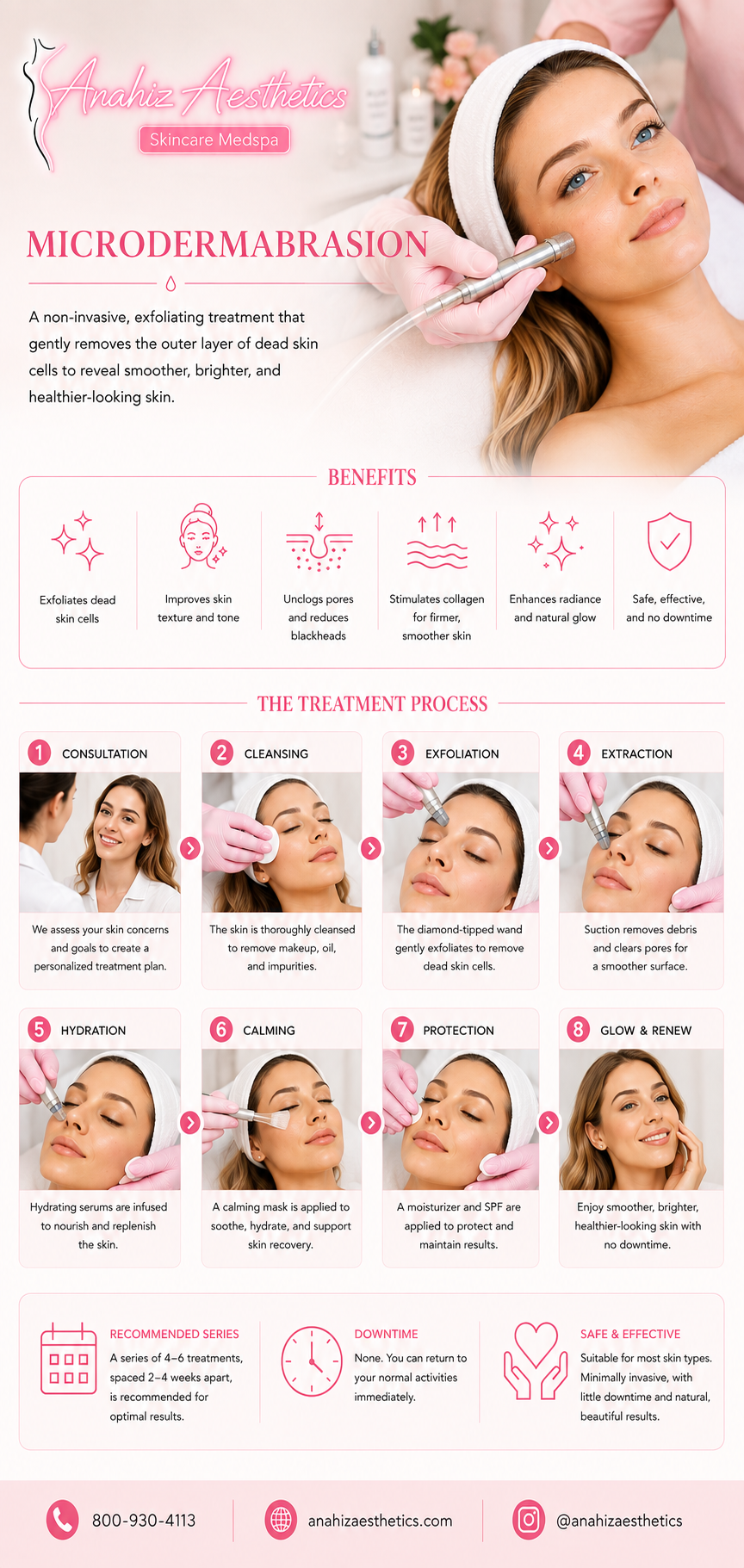 Microdermabrasion — Anahiz Aesthetics 8-step treatment process: consultation, cleansing, exfoliation, extraction, hydration, calming, protection, glow and renew. Benefits: exfoliates dead skin cells, improves skin texture and tone, unclogs pores and reduces blackheads, stimulates collagen, enhances radiance and natural glow, safe and effective with no downtime